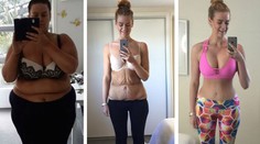 To je premena! Schudla 85 kíl a kožu jej odstraňovali deväť hodín