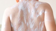 Dieťa nezaočkujete pred najnákazlivejším vírusovým ochorením. Chýbajú vakcíny