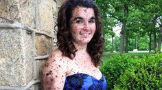 Pre niektorých vyzerá ako špinavá. Ona je na to hrdá