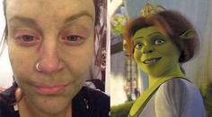 Použila samoopaľovák, skončila ako Fiona zo Shreka