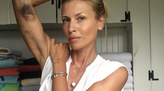 Peštovej dokonalé telo pokryli nepekné modriny. To muselo bolieť