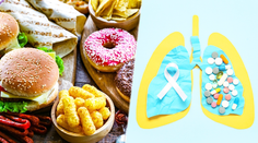 To, čo jete, môže ohroziť vaše pľúca. Nové dáta spájajú ultraspracované potraviny s rakovinou