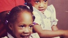 Dvojičky sa narodili ako dievčatá, už sú z nich muži