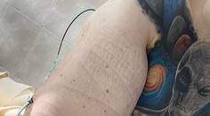 Mladík si do svalov pichal zmes. Z toho, čo v nich teraz mal, zostali lekári zdesení