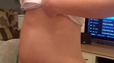 Lekári si mysleli, že je tínedžerka tehotná. Bolo to však niečo strašné