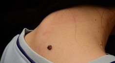 Bolí vás z home officu krčná chrbtica? Poradíme vám cviky a triky ako s tým bojovať