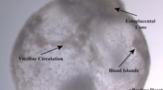 Fantastický pokrok: Vedci vypestovali embryá bez spermií a vajíčok