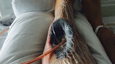 Túžba po dokonalom tele ho takmer zabila. Museli mu vyrezať kus svalu