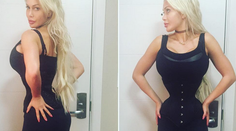 Chce byť ako kreslená postavička. Nechala si odstrániť aj rebrá