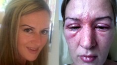 Umelé mihalnice vás môžu dohnať k slepote!