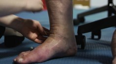 Nevyliečiteľné: Aj Slováci trpia chorobami ako zo seriálu Dr. House