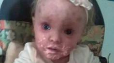 Dievčatku predpovedali, že sa nedožije prvého roka. Jej matka sa však nevzdáva