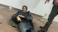 Šokovaní Belgičania! Zranený muž na fotografii je známy športovec