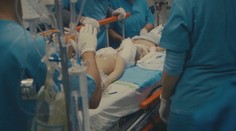 Operácia trvala neuveriteľných 27 hodín. Lekári oddelili bratov, ktorí sa narodili so zrastenými lebkami