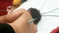 Nebezpečná trampolína: Chlapec pri skákaní skončil s pružinou zabodnutou v tele