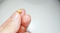 Túto nechutnosť máte možno v hrdle a ani o tom neviete. Spôsobuje výrazný zápach z úst