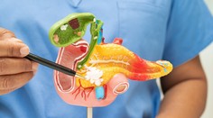 Prelom v liečbe jednej z najzákernejších rakovín. Výsledky prekvapili aj lekárov