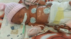 Predčasne narodená Alžbetka boj o život vyhrala. Stále však potrebuje pomoc