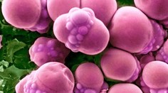 Hádajte, čo je toto. Súvisí to s Vianocami