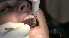 Slováci si berú pôžičky. Napríklad aj na opravu zubov