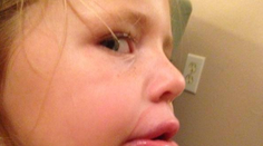 Nový trend zväčšovania pier skúšajú aj deti. Toto všetko im hrozí!