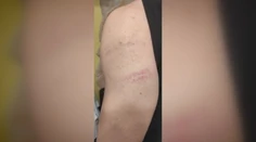 Tínedžer spod Tatier prišiel z mikulášskej akcie s modrinami. Palicou ho mal dobiť čert