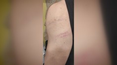 Tínedžer spod Tatier prišiel z mikulášskej akcie s modrinami. Palicou ho mal dobiť čert