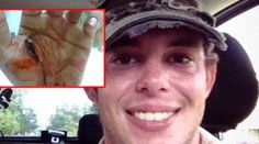 Muža dohrýzol obrovský aligátor: Stretnutie s ním mu bude pripomínať 80 stehov