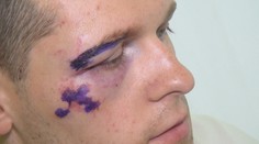 Stačilo málo a cesta z práce sa mohla skončiť tragédiou: Auto nedalo prednosť cyklistovi