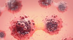 Toto sú kľúčové faktory, ktoré vedú k vzniku rakoviny u mladých ľudí