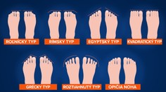 Viete, aký máte typ chodidla? Podľa tvaru zistíte, aké zdravotné problémy vám hrozia