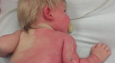 Srdcervúca fotografia: Matka chcela dieťa ovlažiť, namiesto toho ho obarila