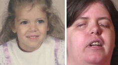 Žena so zdravým zrakom chcela byť slepá. Splnil sa jej sen