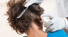 Vši opäť trápia deti na školách. Lekárka vysvetľuje, ako sa ich efektívne zbaviť