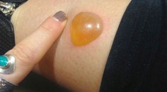 Nechutný pľuzgier odrovnal speváčku. Uhryzol ju pavúk