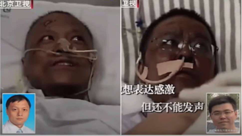 Čínskym pacientom koronavírus napadol pečeň. Zobudili sa s inou farbou pleti