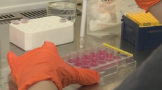 Virológovia sa čudujú, ako Rusi dokážu zneužívať aj vedu. Zaujímalo nás, či zameriavajú aj na slovenské laboratóriá