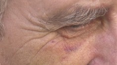 Mladíci zbili dôchodcu, pretože im nedal cigaretu. Ešte ho aj okradli