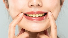 Sú stále žlté, nie žiarivo biele. Zubár prezradil, aké chyby pri čistení zubov robíme