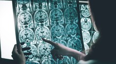 Nádej pre nespočetné množstvo ľudí. Lekári našli nový spôsob včasného odhalenia Alzheimera