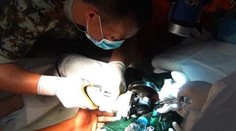 Kuriózny prípad: Mužovi sa zasekol penis v rúrke z klimatizácie