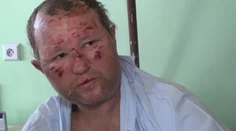 V Trenčíne niekto polial spiacich bezdomovcov benzínom a podpálil