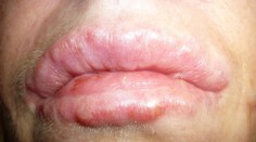 Chcela byť krásna, takto dopadla!