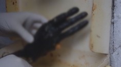 V paneláku našli ruku bez malíčka. Polícia má prvé informácie