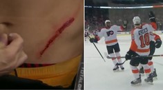 Hokejisti nie sú futbalisti. Schenn dostal korčuľou do brucha, vrátil sa a rozhodol