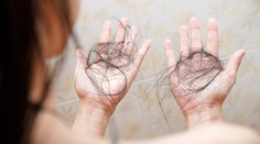 Pozor na ne. Nadmerné užívanie týchto vitamínov môže viesť k vypadávaniu či rednutiu vlasov