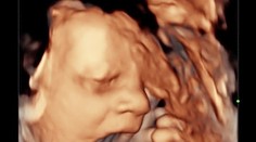 Pár počas predpôrodného ultrazvuku zostal v nemom úžase. Bábätko ukázalo šokujúce gesto