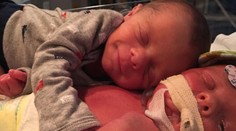 Snímka, ktorá láme srdce. Bábätko objíma svoje umierajúce dvojča