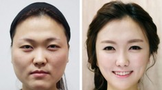 Ani vlastná mater ich nespozná. Výsledok šikovných plastických chirurgov