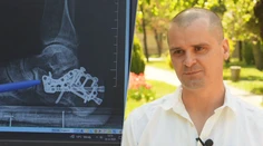 Karol spadol z 30 metrov. Po problémoch s chôdzou lekár odhalil niečo, čo mohlo všetko zmeniť